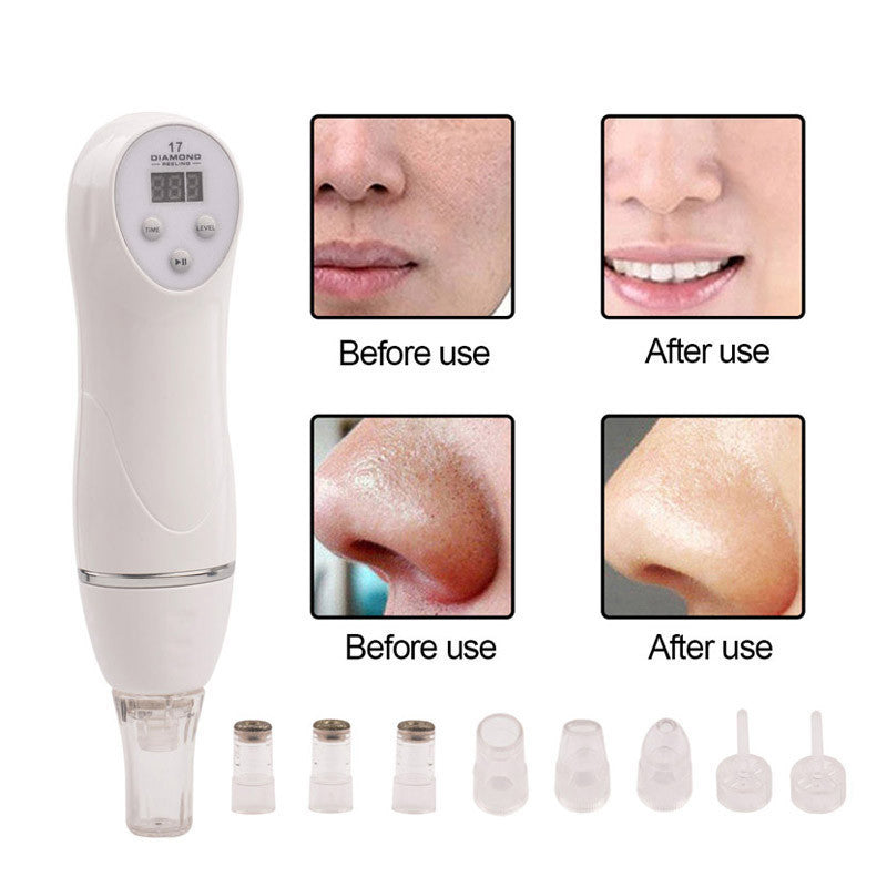 6 Tip Facial Care Beauty Device Skin Diamond Dermabrasion Removal Scar Acne Pore Peeling Machine Care Massager Microdermabrasion